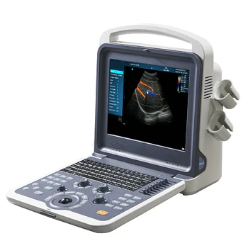 SY-A042-1 Дешевый Цветной Доплеровский портативный ультразвуковой сканер для ноутбука, Медицинский аппарат Usg